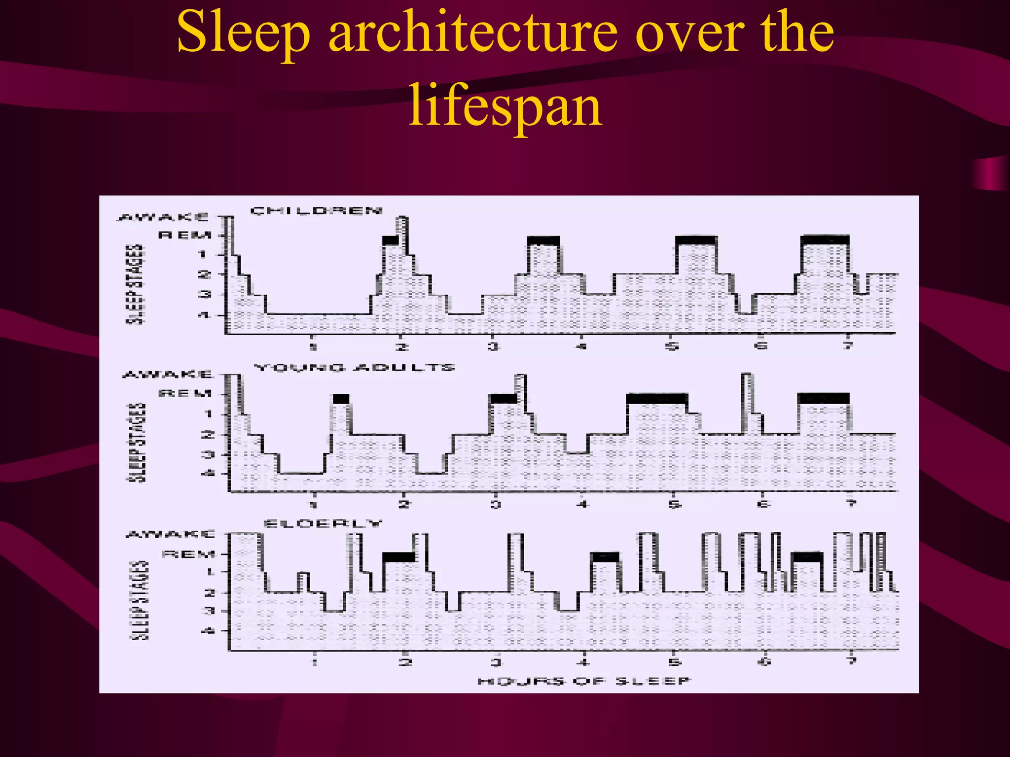 Sleep architecture over the
         lifespan
 