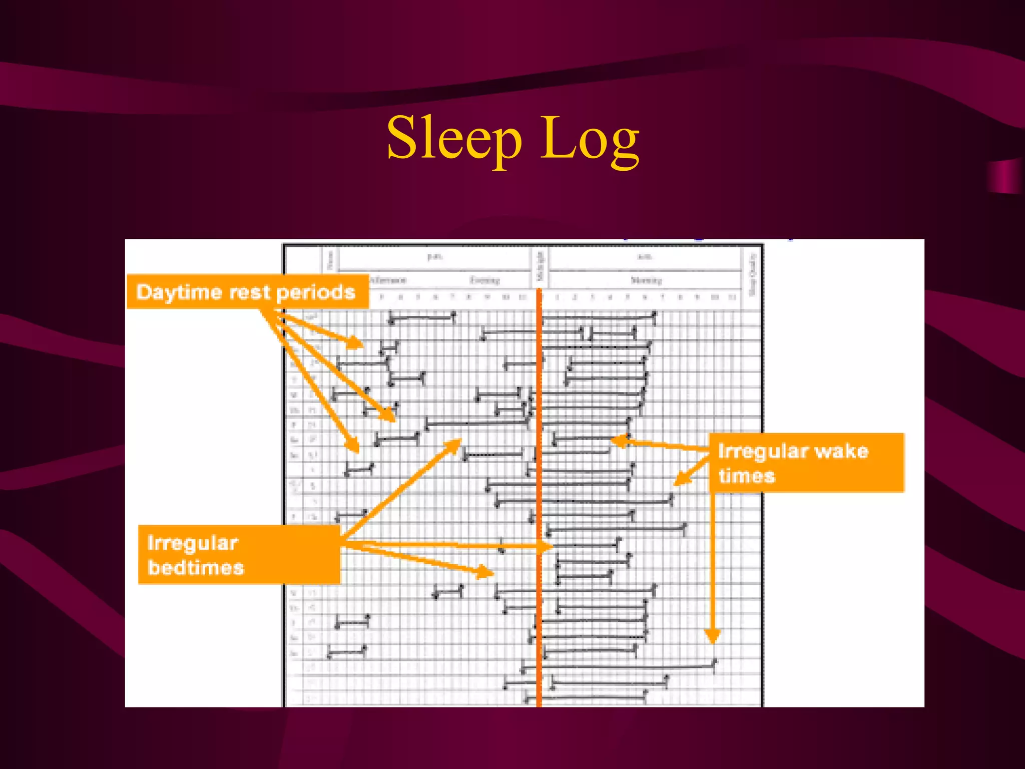 Sleep Log
 