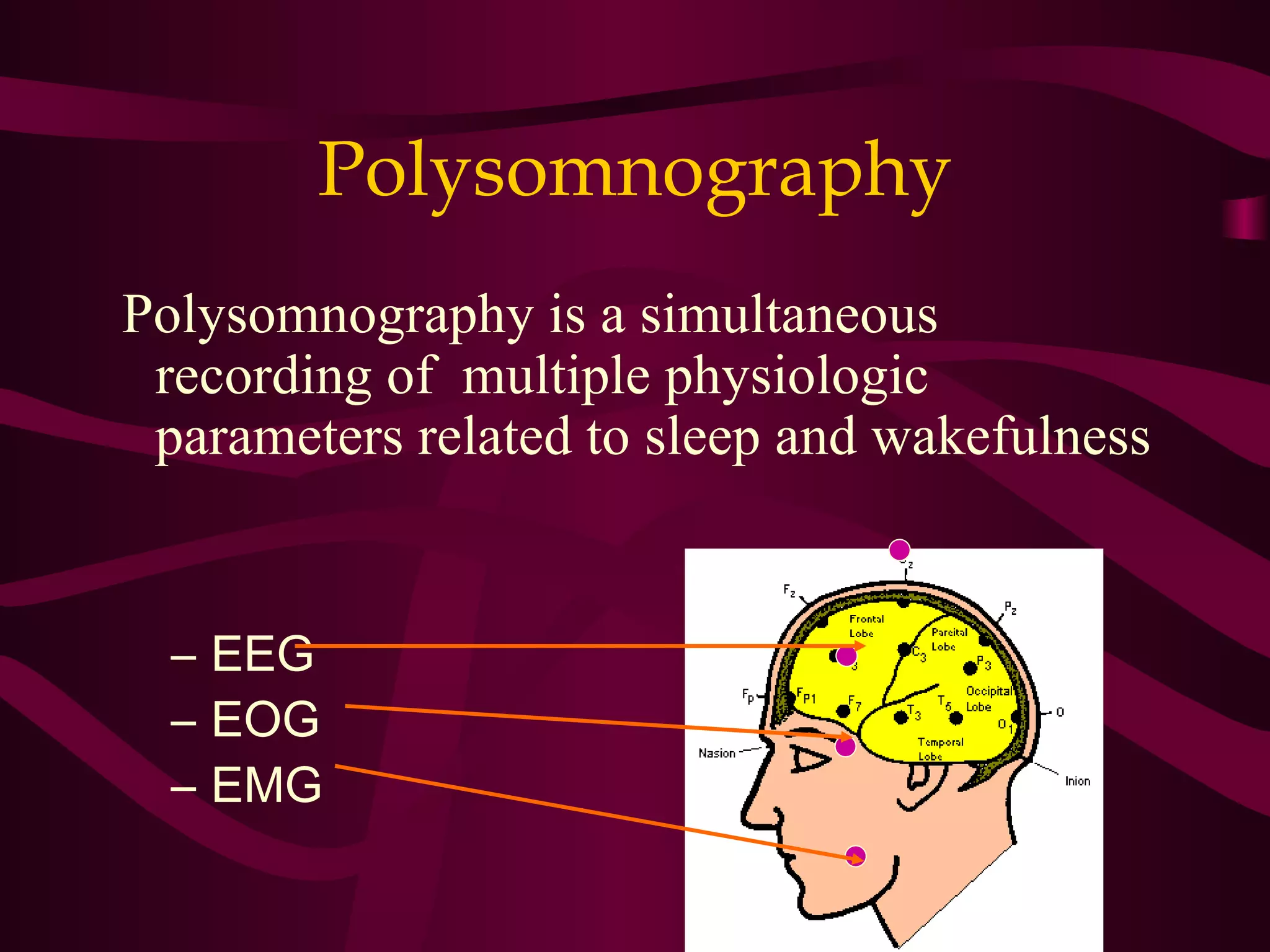 Polysomnography
Polysomnography is a simultaneous
 recording of multiple physiologic
 parameters related to sleep and wakefulness


  – EEG
  – EOG
  – EMG
 