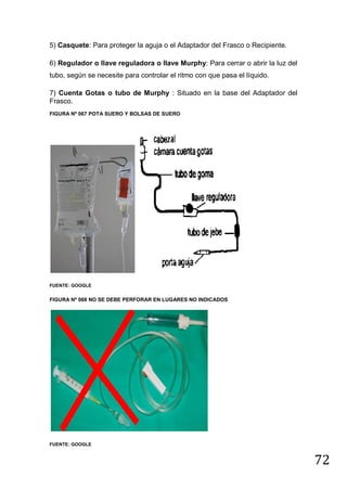 5) Casquete: Para proteger la aguja o el Adaptador del Frasco o Recipiente.
6) Regulador o llave reguladora o llave Murphy: Para cerrar o abrir la luz del
tubo, según se necesite para controlar el ritmo con que pasa el líquido.
7) Cuenta Gotas o tubo de Murphy : Situado en la base del Adaptador del
Frasco.
FIGURA Nº 067 POTA SUERO Y BOLSAS DE SUERO

FUENTE: GOOGLE

FIGURA Nº 068 NO SE DEBE PERFORAR EN LUGARES NO INDICADOS

FUENTE: GOOGLE

72

 