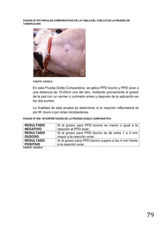 FIGURA Nº 079 PÁPULAS COMPARATIVAS EN LA TABLA DEL CUELLO EN LA PRUEBA DE
TUBERCULINA

FUENTE: GOOGLE

En esta Prueba Doble Comparativa, se aplica PPD bovino y PPD aviar a
una distancia de 15-20cm uno del otro, midiendo previamente el grosor
de la piel con un vernier o cutímetro antes y después de la aplicación en
los dos puntos.
La finalidad de esta prueba es determinar si la reacción inflamatoria es
por M. bovis o por otras micobacterias.
FIGURA Nº 080 INTERPRETACIÓN DE LA PRUEBA DOBLE COMPARATIVA

RESULTADO
NEGATIVO
RESULTADO
DUDOSO
RESULTADO
POSITIVO

Si el grosor para PPD bovino es menor o igual a la
reacción al PPD aviar.
Si el grosor para PPD bovino es de entre 1 a 4 mm
mayor a la reacción aviar.
Si el grosor para PPD bovino supera a los 4 mm frente
a la reacción aviar.

FUENTE: GOOGLE

79

 