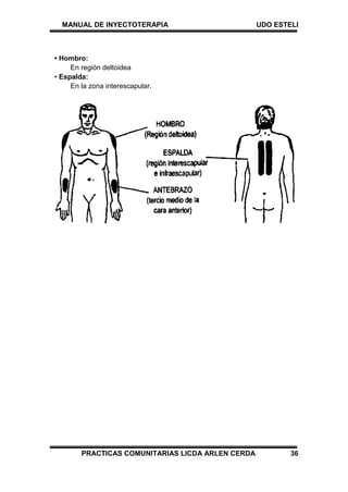 MANUAL DE INYECTOTERAPIA UDO ESTELI
PRACTICAS COMUNITARIAS LICDA ARLEN CERDA 36
• Hombro:
En región deltoidea
• Espalda:
En la zona interescapular.
 