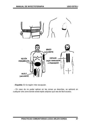 MANUAL DE INYECTOTERAPIA UDO ESTELI
PRACTICAS COMUNITARIAS LICDA ARLEN CERDA 47
- Espalda: En la región ínter escapular.
- En caso de no poder aplicar en las zonas ya descritas, se aplicará en
cualquier otra zona donde exista tejido adiposo que sea de fácil acceso.
 