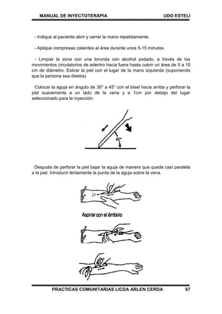 MANUAL DE INYECTOTERAPIA UDO ESTELI
PRACTICAS COMUNITARIAS LICDA ARLEN CERDA 67
- Indique al paciente abrir y cerrar la mano repetidamente.
- Aplique compresas calientes al área durante unos 5-15 minutos.
- Limpiar la zona con una torunda con alcohol yodado, a través de los
movimientos circulatorios de adentro hacia fuera hasta cubrir un área de 5 a 10
cm de diámetro. Estirar la piel con el lugar de la mano izquierda (suponiendo
que la persona sea diestra)
Colocar la aguja en ángulo de 30° a 45° con el bisel hacia arriba y perforar la
piel suavemente a un lado de la vena y a 1cm por debajo del lugar
seleccionado para la inyección.
Después de perforar la piel bajar la aguja de manera que quede casi paralela
a la piel. Introducir lentamente la punta de la aguja sobre la vena.
 