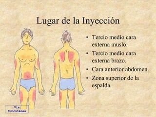 Lugar de la Inyección
• Tercio medio cara
externa muslo.
• Tercio medio cara
externa brazo.
• Cara anterior abdomen.
• Zona superior de la
espalda.
Vía
Subcutánea
 