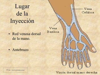 Lugar
de la
Inyección
• Red venosa dorsal
de la mano.
• Antebrazo.
Vía intravenosa
 