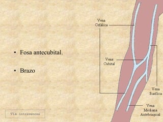 • Fosa antecubital.
• Brazo
Vía intravenosa
 