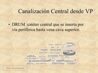 Canalización Central desde VP
• DRUM :catéter central que se inserta por
vía periférica hasta vena cava superior.
Vía intravenosa
 