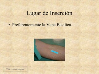 Lugar de Inserción
• Preferentemente la Vena Basílica.
Vía intravenosa
 