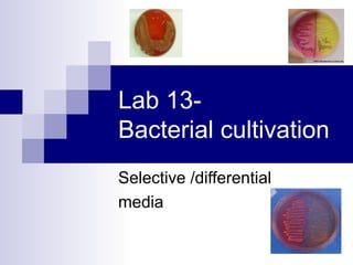 Lab 13-
Bacterial cultivation
Selective /differential
media
 