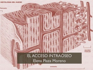 EL ACCESO INTRAÓSEO
Elena Plaza Moreno
 