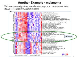 Another Example - melanoma
16	
PD-1 resistance signature in melanoma Hugo	et	al.,	2016,	Cell	165,	1–10	
hMp://dx.doi.org/1...