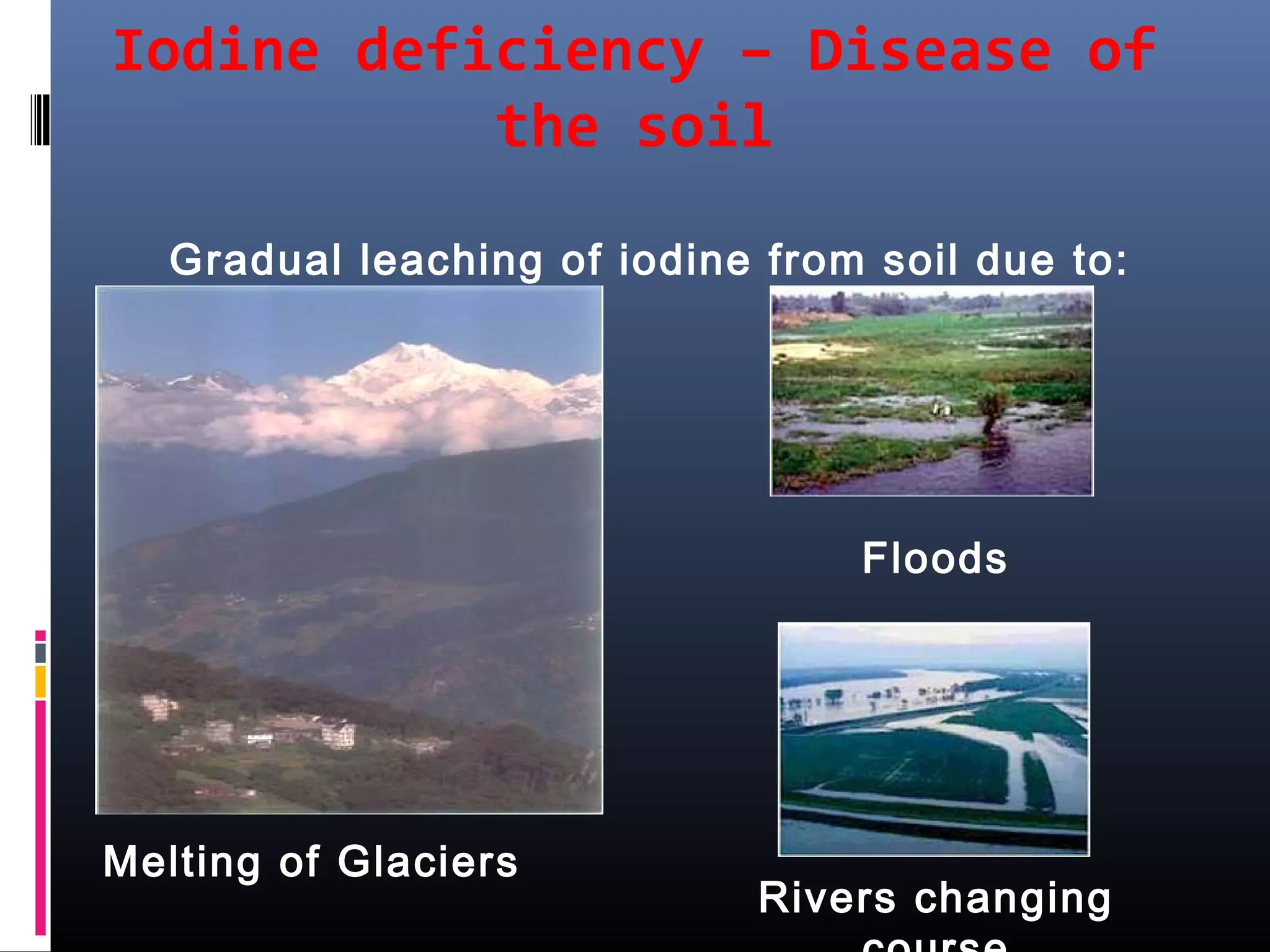 Iodine defficiancy disorders | PPT | Thyroid Disorders | Endocrine and ...