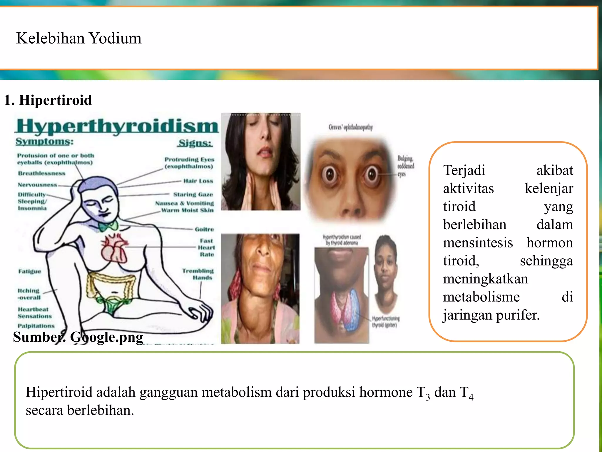 Iodium [autosaved] | PPTX