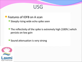 USG
Features of IOFB on A scan
Steeply rising wide echo spike seen
The reflectivity of the spike is extremely high (100% ) which
persists on low gain
Sound attenuation is very strong
 