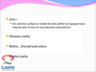 Lens –
On anterior surface or inside the lens (either an opaque tract
may be seen in lens or may become cataractous)
Vitreous cavity
Retina , choroid and sclera
Orbital cavity
 