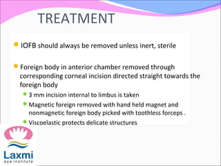 Intraocular Foreign Body