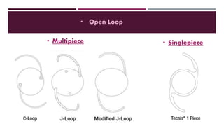 • Open Loop
• Multipiece • Singlepiece
 