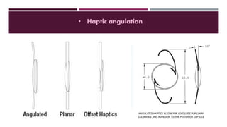 • Haptic angulation
 