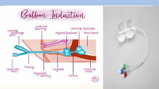 Induction of Labour: medical and surgical method | PPTX