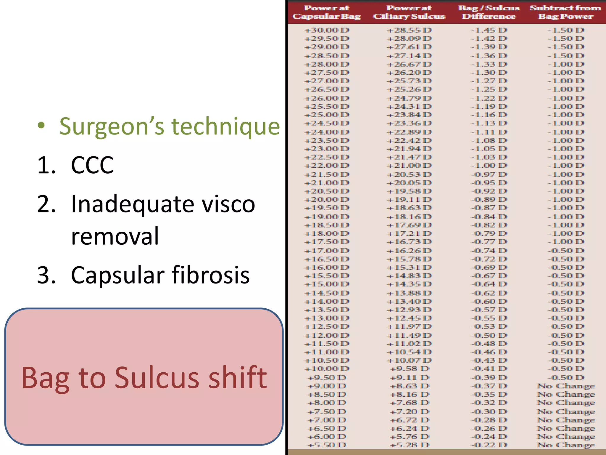 • Surgeon’s technique
1. CCC
2. Inadequate visco
removal
3. Capsular fibrosis
Bag to Sulcus shift
 