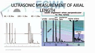 ULTRASONIC MEASUREMENT OF AXIAL
LENGTH
16TH SEPTEMBER, 2020 8:00AM
 