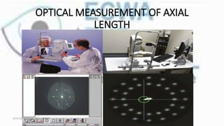 OPTICAL MEASUREMENT OF AXIAL
LENGTH
16TH SEPTEMBER, 2020 8:00AM
 