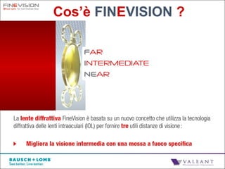 Iol finevision trifocale dr baldino 6refractive live surgery poliambu…