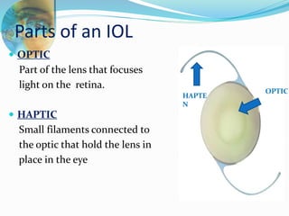 Parts of an IOL
 OPTIC
Part of the lens that focuses
light on the retina.
 HAPTIC
Small filaments connected to
the optic that hold the lens in
place in the eye
HAPTE
N
OPTIC
 