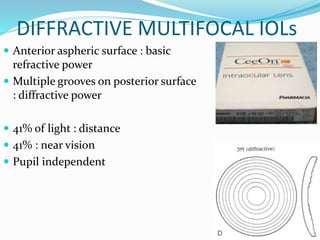 DIFFRACTIVE MULTIFOCAL IOLs
 Anterior aspheric surface : basic
refractive power
 Multiple grooves on posterior surface
: diffractive power
 41% of light : distance
 41% : near vision
 Pupil independent
 