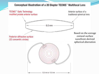Based on the average
corneal-surface
wavefront-derived
spherical aberration
 