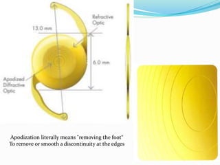 Apodization literally means "removing the foot“
To remove or smooth a discontinuity at the edges
 
