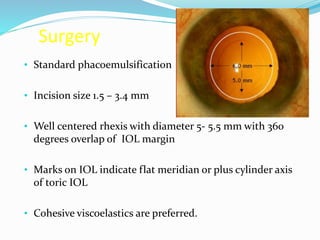 Surgery
• Standard phacoemulsification
• Incision size 1.5 – 3.4 mm
• Well centered rhexis with diameter 5- 5.5 mm with 360
degrees overlap of IOL margin
• Marks on IOL indicate flat meridian or plus cylinder axis
of toric IOL
• Cohesive viscoelastics are preferred.
 