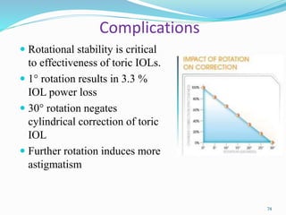 Complications
 Rotational stability is critical
to effectiveness of toric IOLs.
 1° rotation results in 3.3 %
IOL power loss
 30° rotation negates
cylindrical correction of toric
IOL
 Further rotation induces more
astigmatism
74
 