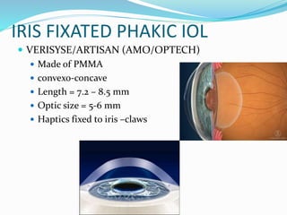 IRIS FIXATED PHAKIC IOL
 VERISYSE/ARTISAN (AMO/OPTECH)
 Made of PMMA
 convexo-concave
 Length = 7.2 – 8.5 mm
 Optic size = 5-6 mm
 Haptics fixed to iris –claws
 