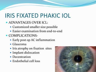 IRIS FIXATED PHAKIC IOL
 ADVANTAGES OVER ICL:
 Customized smaller size possible
 Easier examination from end-to-end
 COMPLICATIONS-
 Early post op AC inflammation
 Glaucoma
 Iris atrophy on fixation sites
 Implant dislocation
 Decentration
 Endothelial cell loss
 