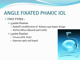 ANGLE FIXATED PHAKIC IOL
 TWO TYPES –
 4 point fixation
 Baikoff’s modification of Kelman type haptic design
 NuVita MA20 (Bausch and Lomb)
 3 point fixation
 Vivarte (IOL Tech)
 Separate optic and haptic
 