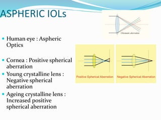 ASPHERIC IOLs
 Human eye : Aspheric
Optics
 Cornea : Positive spherical
aberration
 Young crystalline lens :
Negative spherical
aberration
 Ageing crystalline lens :
Increased positive
spherical aberration
 