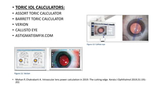 • TORIC IOL CALCULATORS:
• ASSORT TORIC CALCULATOR
• BARRETT TORIC CALCULATOR
• VERION
• CALLISTO EYE
• ASTIGMATISMFIX.COM
• Mohan P, Chakrabarti A. Intraocular lens power calculation in 2019: The cutting edge. Kerala J Ophthalmol 2019;31:191-
201
 