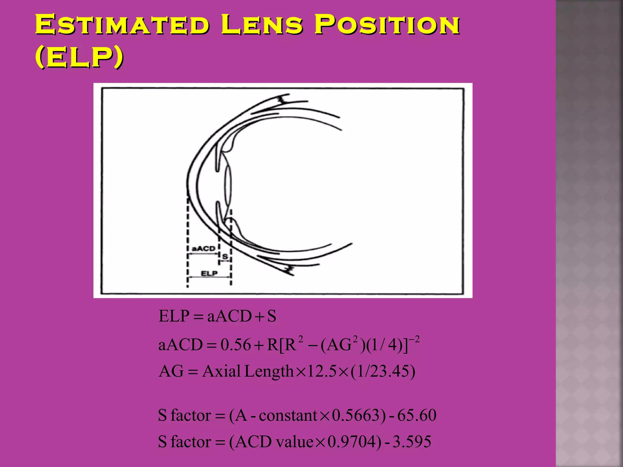 Estimated Lens PositionEstimated Lens Position
(ELP)(ELP)
(1/23.45)12.5LengthAxialAG
)]4/1)((AGR[R0.56aACD
SaACDELP
222
××=
−+=
+=
−
3.595-0.9704)value(ACDfactorS
65.60-0.5663)constant-(AfactorS
×=
×=
 