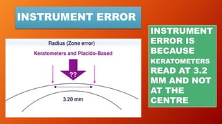 INSTRUMENT ERROR
INSTRUMENT
ERROR IS
BECAUSE
KERATOMETERS
READ AT 3.2
MM AND NOT
AT THE
CENTRE
 