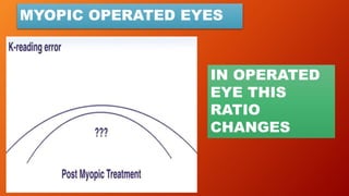 MYOPIC OPERATED EYES
IN OPERATED
EYE THIS
RATIO
CHANGES
 