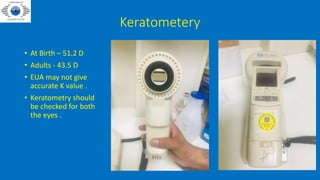 Keratometery
• At Birth – 51.2 D
• Adults - 43.5 D
• EUA may not give
accurate K value .
• Keratometry should
be checked for both
the eyes .
 