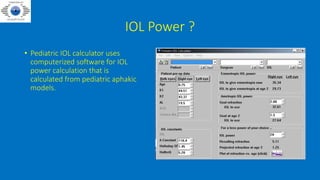 IOL Power ?
• Pediatric IOL calculator uses
computerized software for IOL
power calculation that is
calculated from pediatric aphakic
models.
 