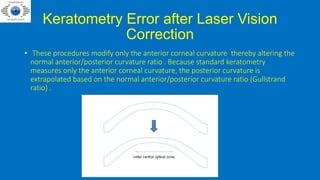 Keratometry Error after Laser Vision
Correction
• These procedures modify only the anterior corneal curvature thereby altering the
normal anterior/posterior curvature ratio . Because standard keratometry
measures only the anterior corneal curvature, the posterior curvature is
extrapolated based on the normal anterior/posterior curvature ratio (Gullstrand
ratio) .
 