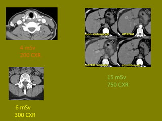 15 mSv 
750 CXR 
4 mSv 
200 CXR 
6 mSv 
300 CXR 
 