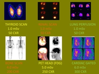 THYROID SCAN RENAL SCAN LUNG PERFUSION 
1.0 mSv 1.0 mSv 1.0 mSv 
50 CXR 50 CXR 50 CXR 
BONE SCAN PET HEAD (FDG) CARDIAC GATED 
4.0 mSv 5.0 mSv 6.0 mSv 
200 CXR 250 CXR 300 CXR 
 
