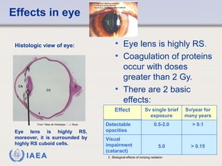 Effects in eye 
• Eye lens is highly RS. 
• Coagulation of proteins 
occur with doses 
greater than 2 Gy. 
• There are 2 basic 
effects: 
Histologic view of eye: 
From “Atlas de Histologia...”. J. Boya 
Detectable 0.5-2.0 > 0.1 
opacities 
Eye lens is highly RS, 
moreover, it is surrounded by 
highly RS cuboid cells. 5.0 > 0.15 
Visual 
impairment 
(cataract) 
IAEA 3 : Biological effects of ionizing radiation 
Sv/year for 
many years 
Sv single brief 
exposure 
Effect 
 