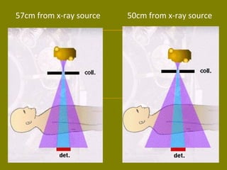 57cm from x-ray source 50cm from x-ray source 
 