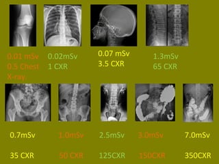 0.01 mSv 
0.5 Chest 
X-ray. 
0.02mSv 
1 CXR 
0.07 mSv 
3.5 CXR 
1.3mSv 
65 CXR 
0.7mSv 1.0mSv 2.5mSv 3.0mSv 7.0mSv 
35 CXR 50 CXR 125CXR 150CXR 350CXR 
 